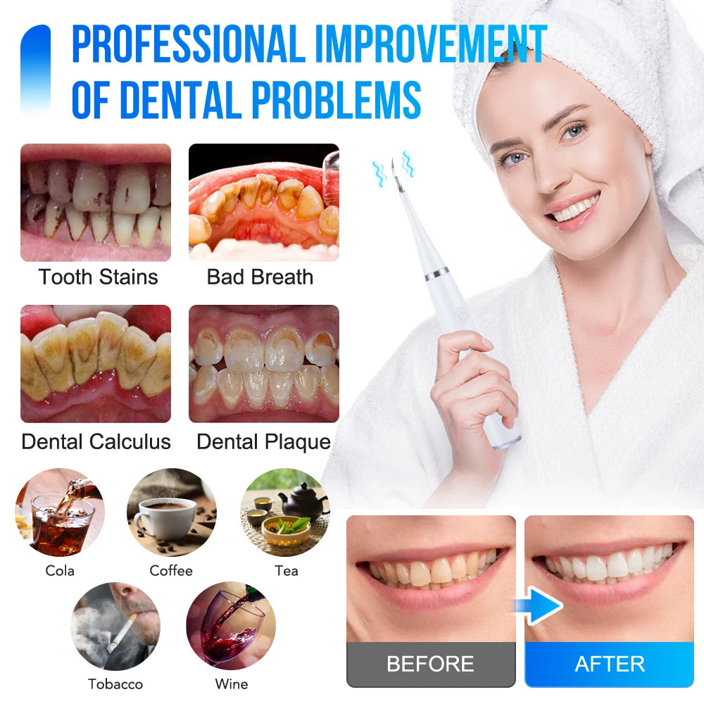 Electric Sonic Dental Scaler Teeth Whitening Cleaning Tool With Electric Toothbrush Head Calculus Remover Oral Irrigator Cleaner