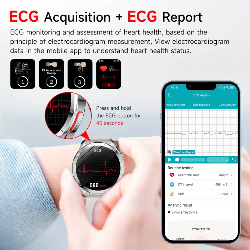 Marsyu 2026 Smart Watch ECG+PPG