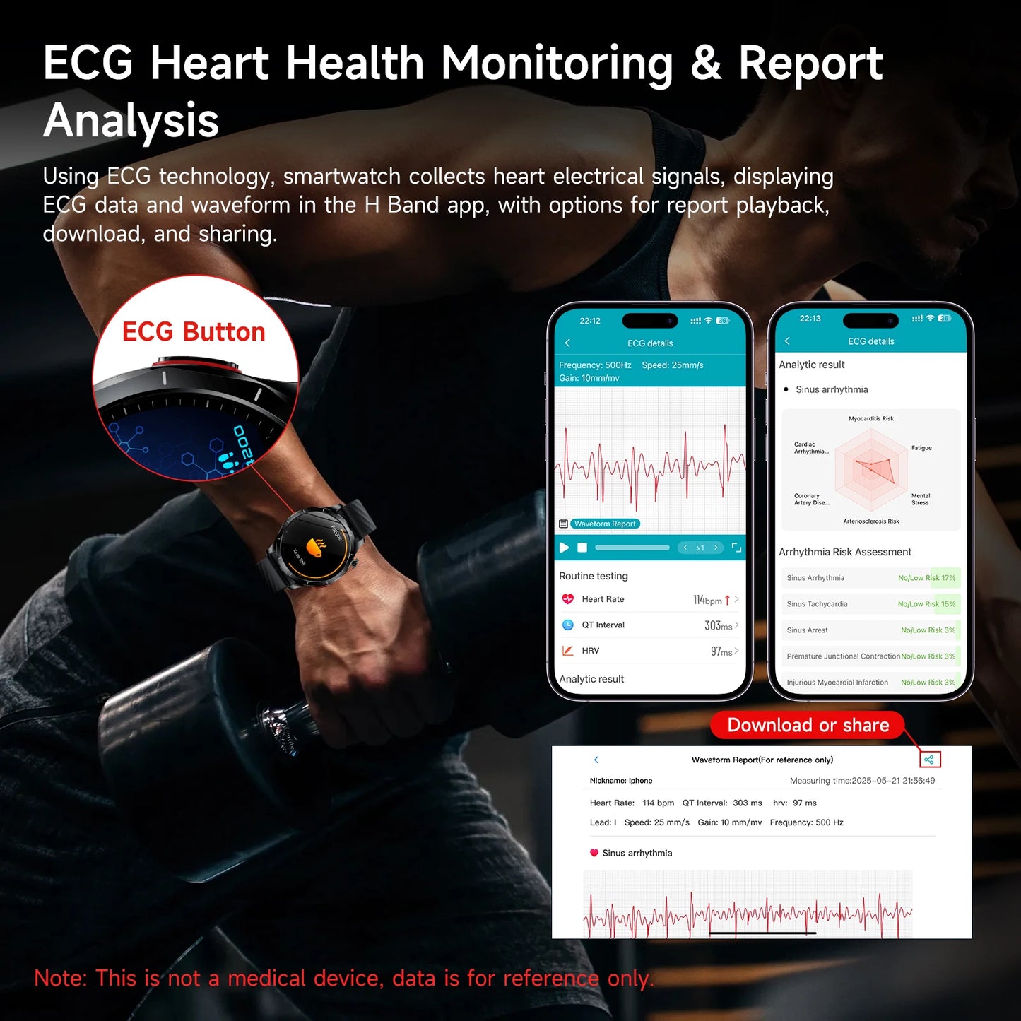 Marsyu ECG+PPG Health Diagnosis Smart watch Men's, Women's