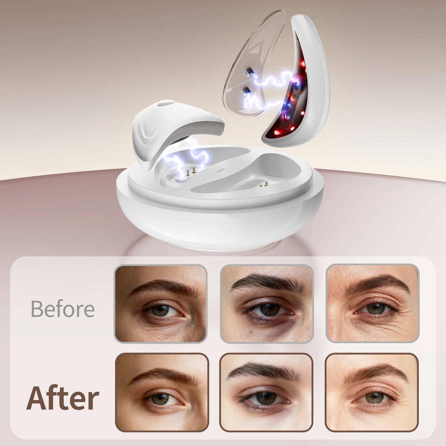 EMS Redlight Eye Massage