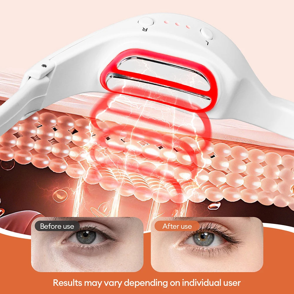 Foreverlily 3D Eyes Relax Massager EMS Eye Massage Glasses